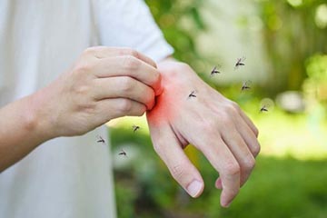 Comment se débarrasser des moustiques?